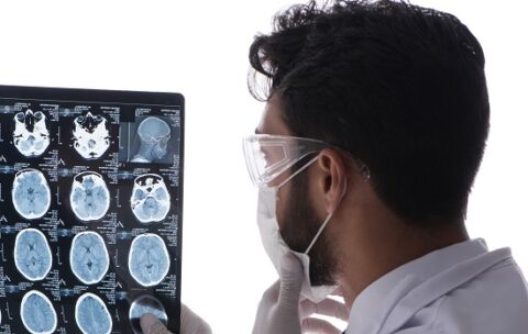 Young doctor looking at x-ray images isolated on white