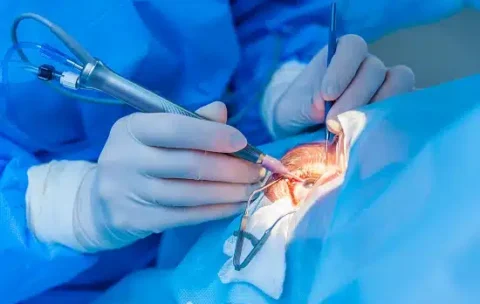 Ophthalmology_Depositphotos_103330030_XL.jpg