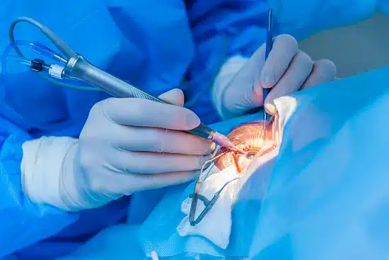 Ophthalmology
