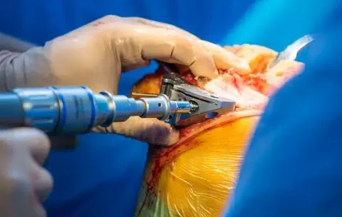 Orthopedics_iStock-506588030.jpg