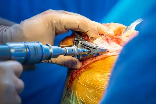 Orthopedics