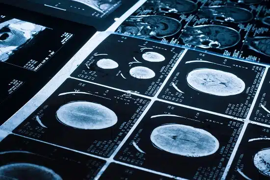Radio Diagnosis