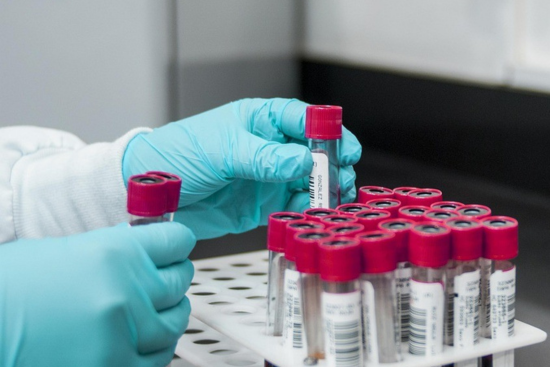 Immunohaematology & Blood Transfusion